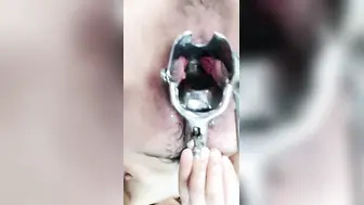 羞涩小仙女全程露脸丝袜高跟来看看逼逼的淫水多不多，扩阴器撑开骚穴跳蛋塞进去自慰骚穴，啤酒瓶插逼呻吟