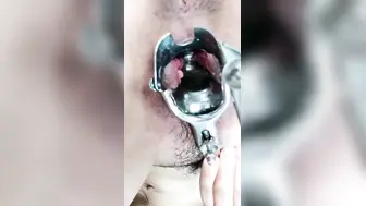 羞涩小仙女全程露脸丝袜高跟来看看逼逼的淫水多不多，扩阴器撑开骚穴跳蛋塞进去自慰骚穴，啤酒瓶插逼呻吟