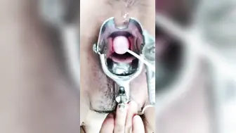 羞涩小仙女全程露脸丝袜高跟来看看逼逼的淫水多不多，扩阴器撑开骚穴跳蛋塞进去自慰骚穴，啤酒瓶插逼呻吟