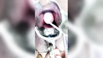 羞涩小仙女全程露脸丝袜高跟来看看逼逼的淫水多不多，扩阴器撑开骚穴跳蛋塞进去自慰骚穴，啤酒瓶插逼呻吟